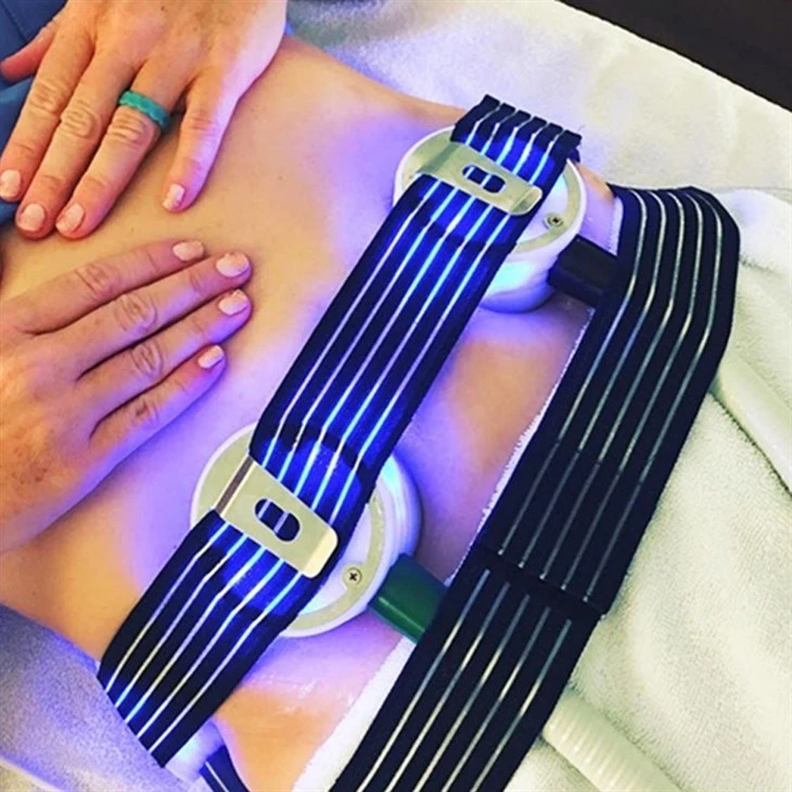2024Cryoskin Slimming Machine